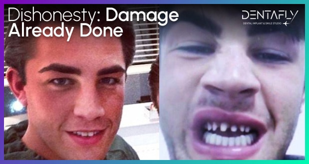 Jack's Teeth Damage