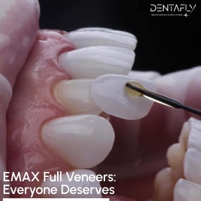 eMax full veneers shadow and brightness change after treatment