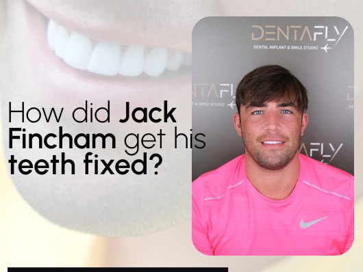 How did Jack get his teeth done?