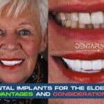 Dental Implants for Seniors in Turkey