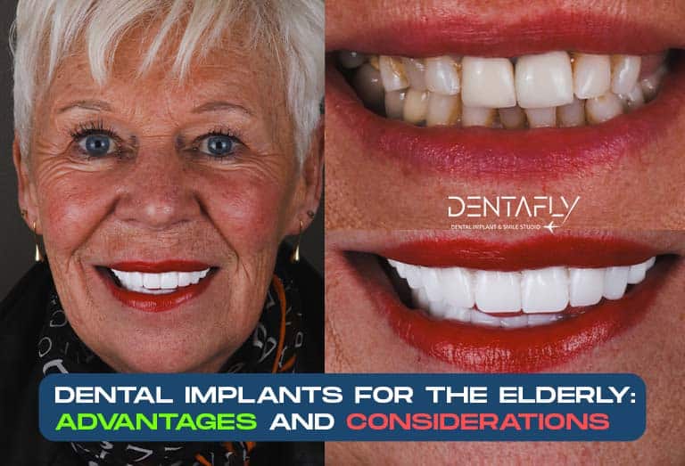 Dental implant treatment for a lady 65+ years old