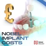 Nobel Brand dental implant cost