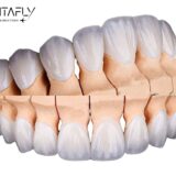 Full set of dental veneers simulation view
