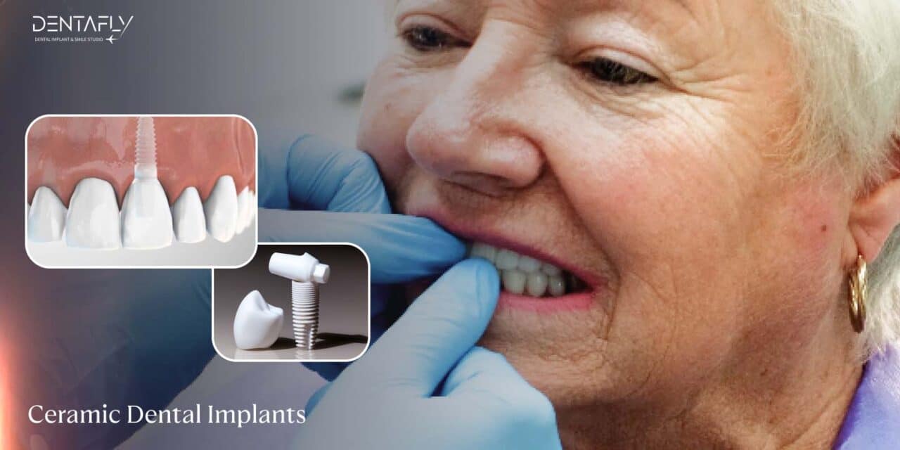 Ceramic Dental Implants: Transforming Oral Rehabilitation with Aesthetic Solutions