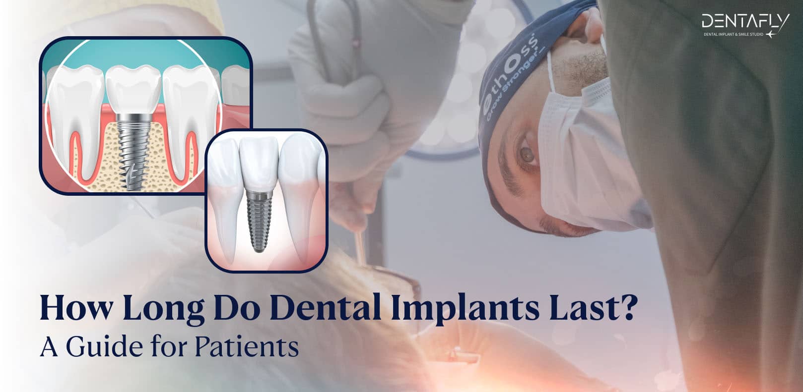 How long do dental implants