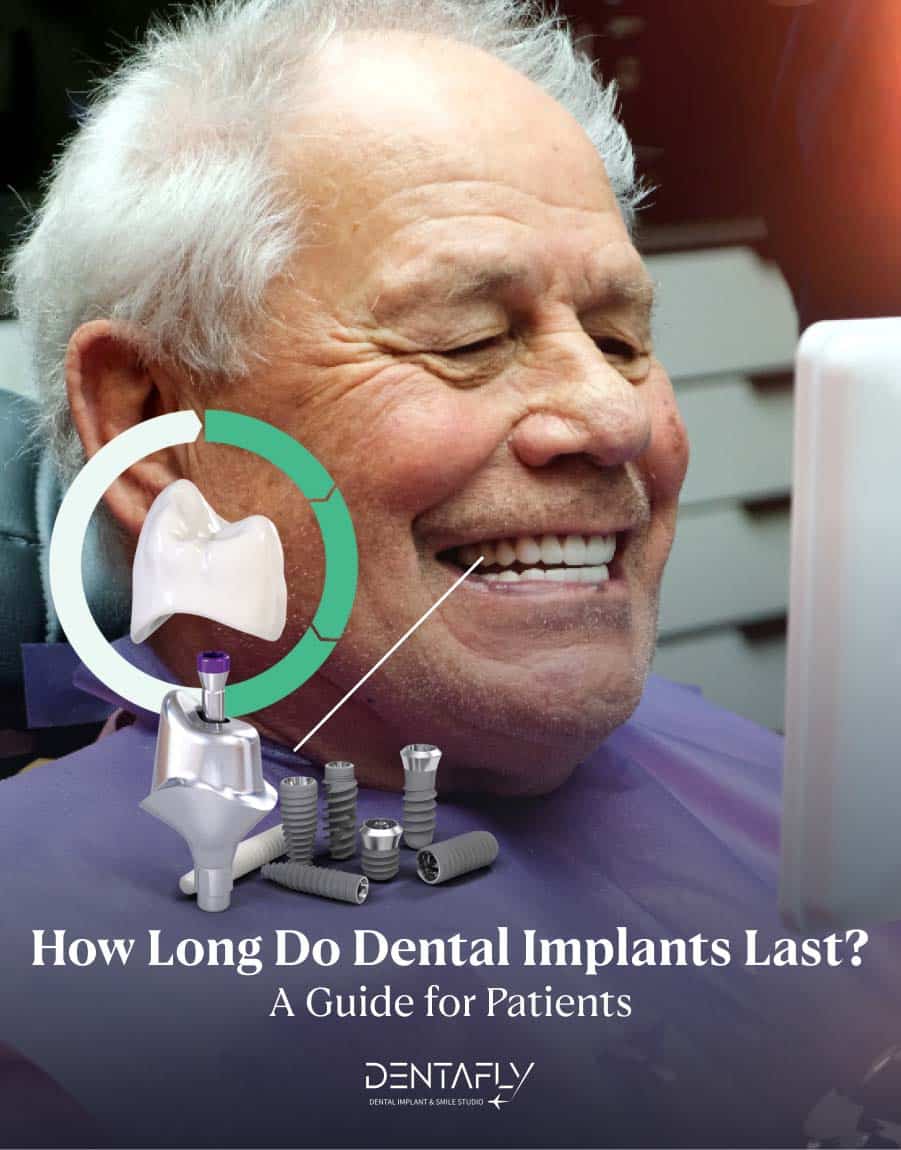 Dental Implants Illustration