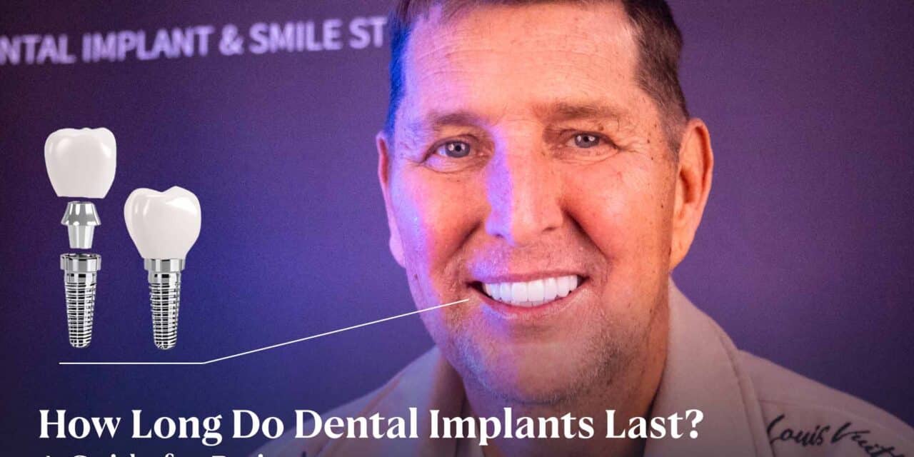 How Long Do Dental Implants Last? A Guide for Patients