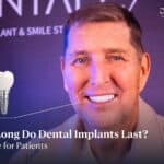 How Long do Dental Implants