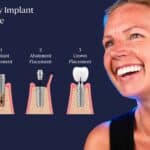 same day implant procedure