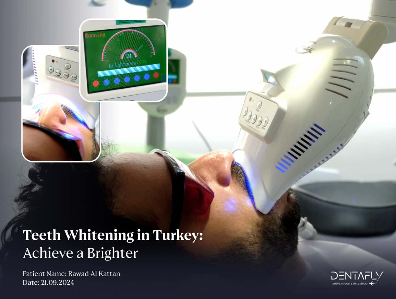 Laser Teeth Whitening Turkey