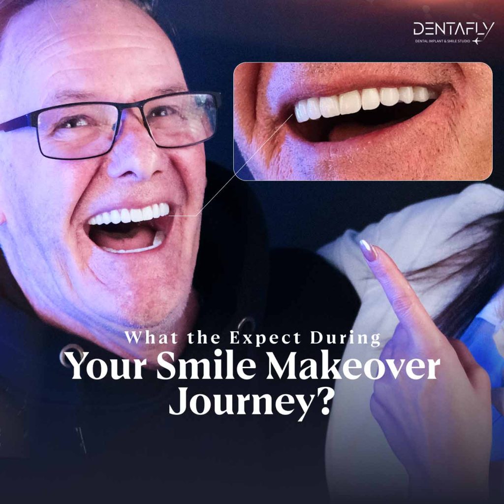What to Expect on a Smile Makeover Journey