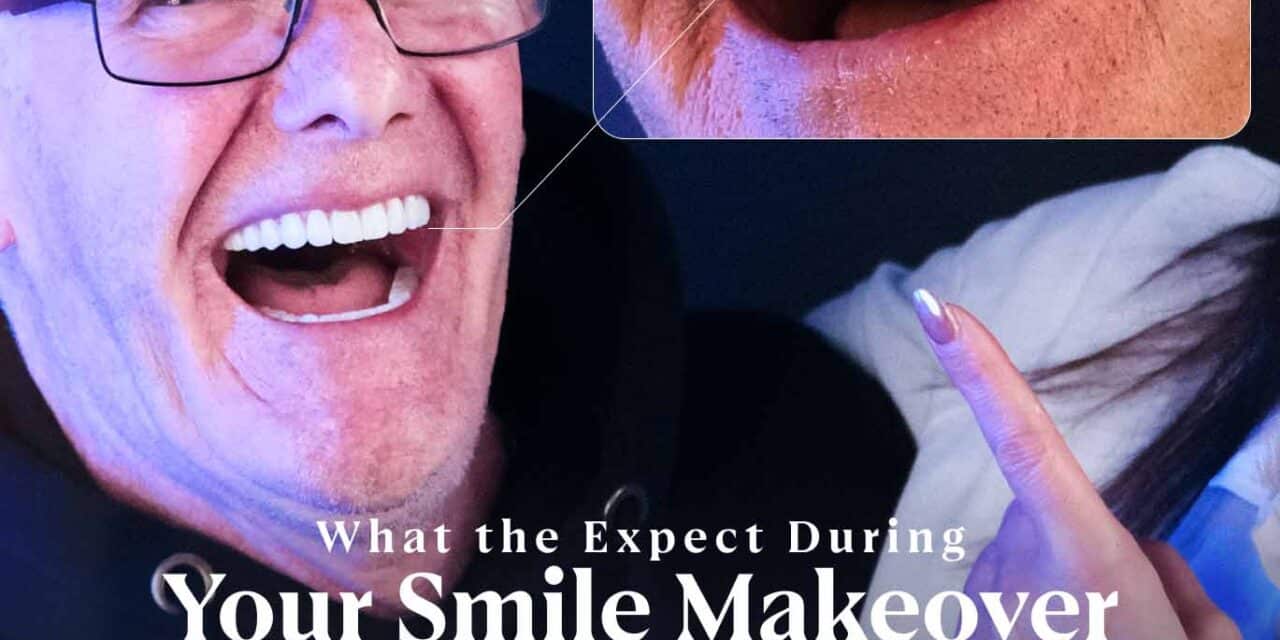 What to Expect on a Smile Makeover Journey