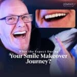 What-to-expect-during-your-Smile-Makeover-Journey