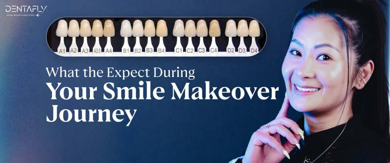 What-to-expect-during-your-Smile-Makeover-Journey-2