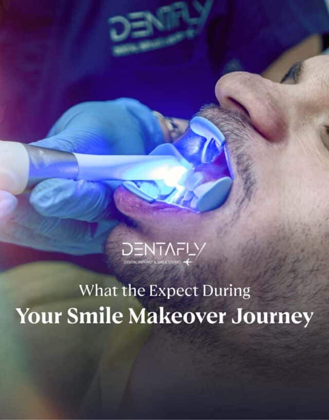 What-to-expect-during-your-Smile-Makeover-Journey-7