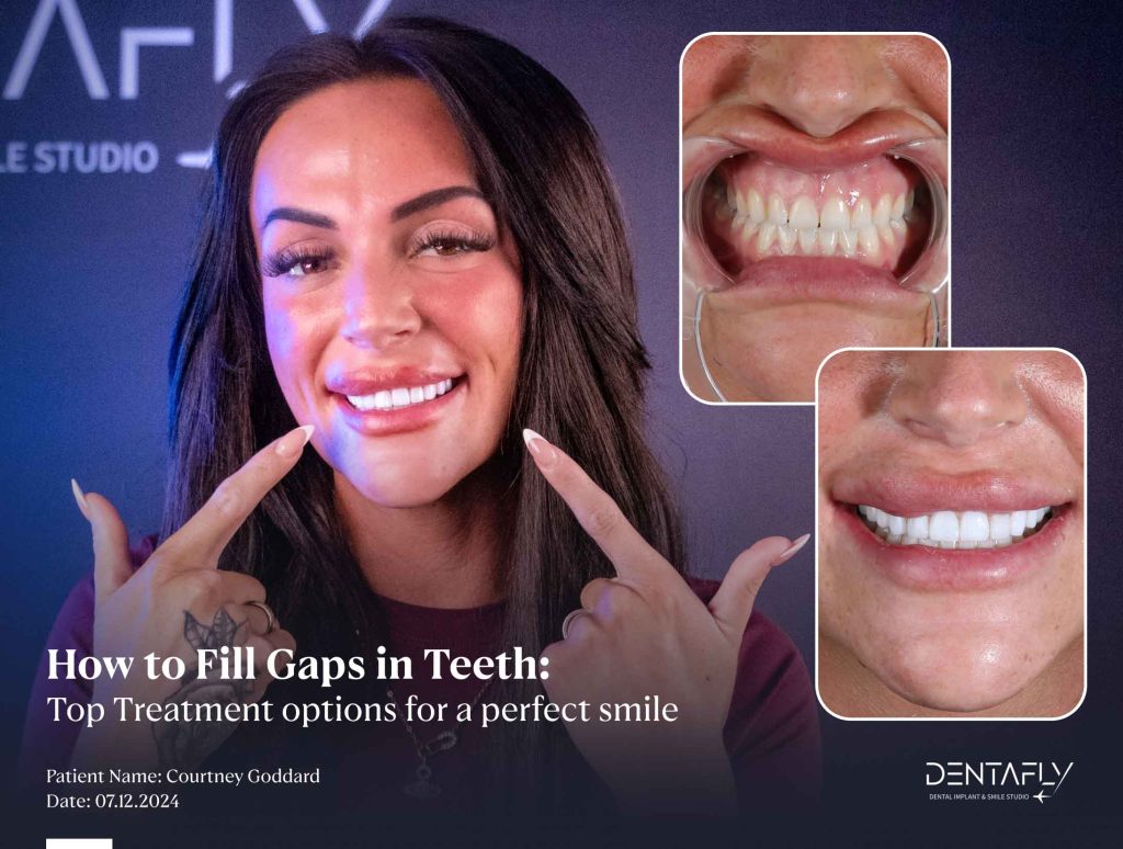 How to Fill Gaps in Teeth: Top Treatment Options for a Perfect Smile