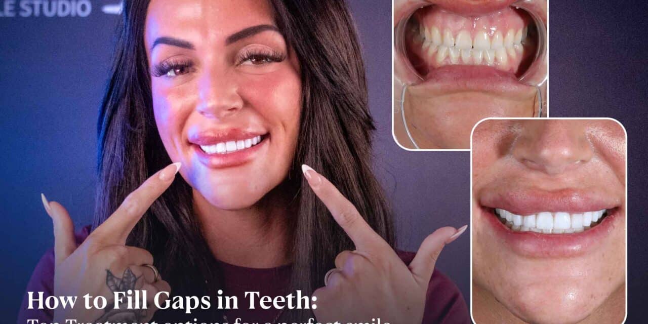 How to Fill Gaps in Teeth: Top Treatment Options for a Perfect Smile