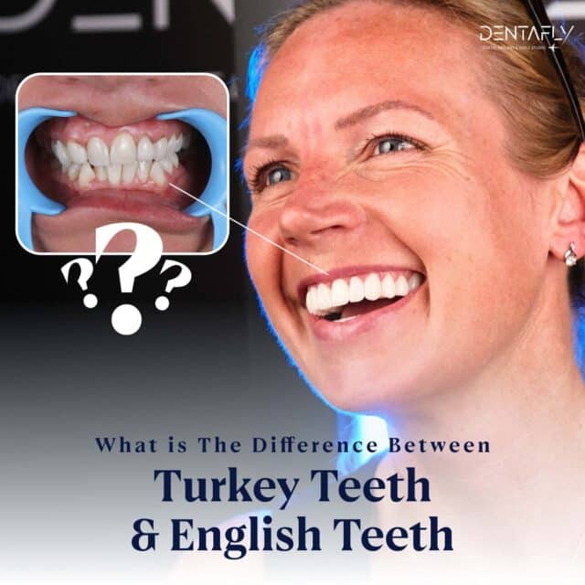 Difference Between Turkey Teeth and English Teeth