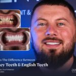 Difference between Turkey Teeth and English Teeth