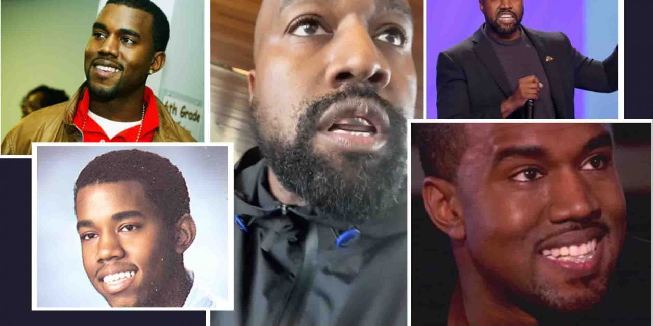 Kanye West’s Teeth: Complete Guide, Costs, Before & After Transformation