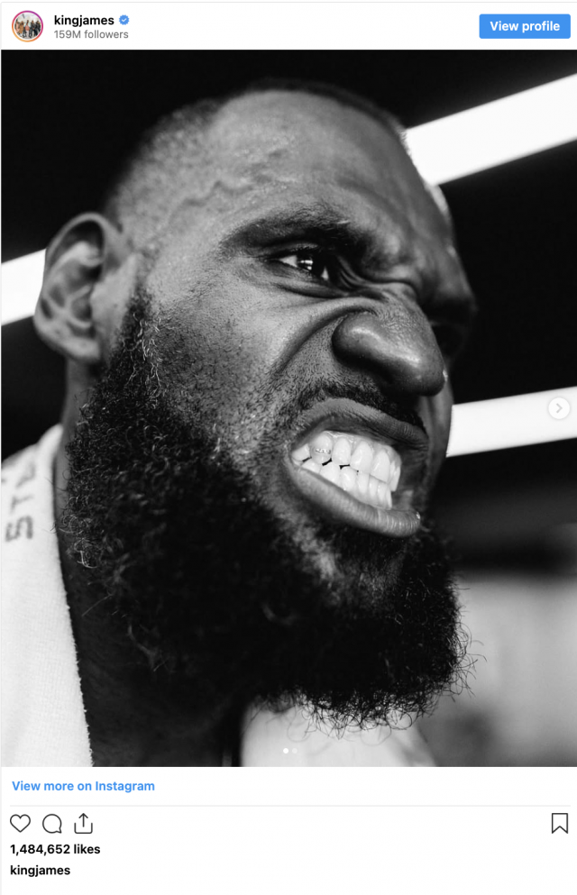 LeBron James teeth transformation