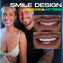 smile design before after gallery thumbnails