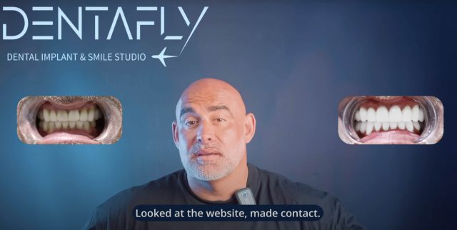 Mr. Stuart's Life-Changing Smile Transformation with Turkey Teeth