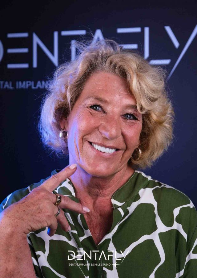 Cross-section X-ray view of a dental implant securely placed in the upper jaw after a successful closed sinus lifting procedure.