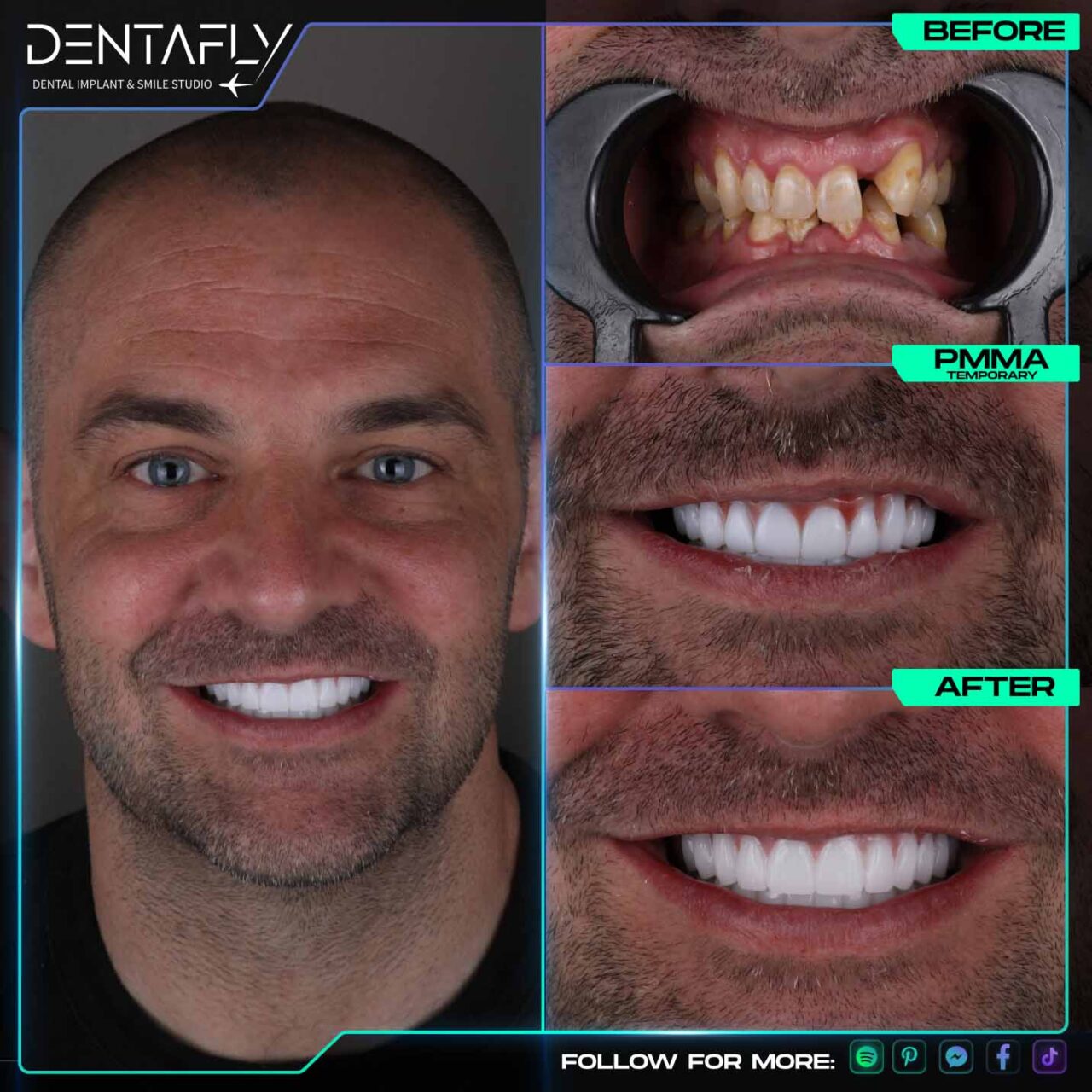 Adam Spencer smile before and after