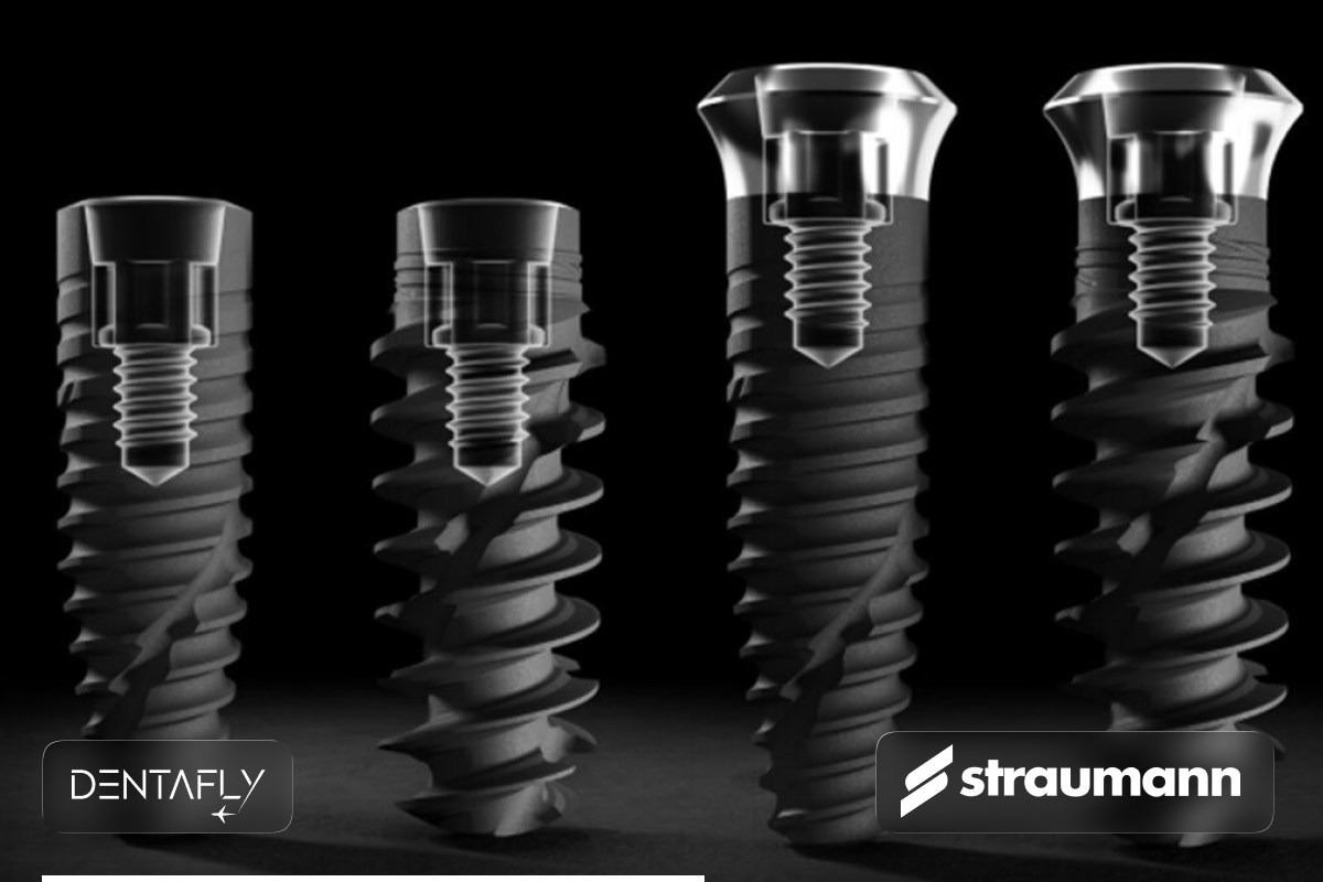 Best dental implant brands Straumann Nobel Biocare Hiossen Megagen for single tooth replacement