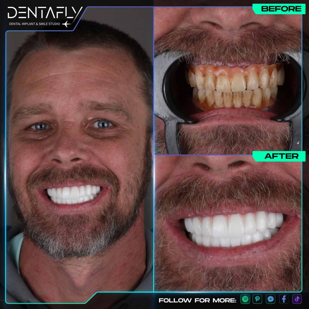 Chris Sinclair smile before and after