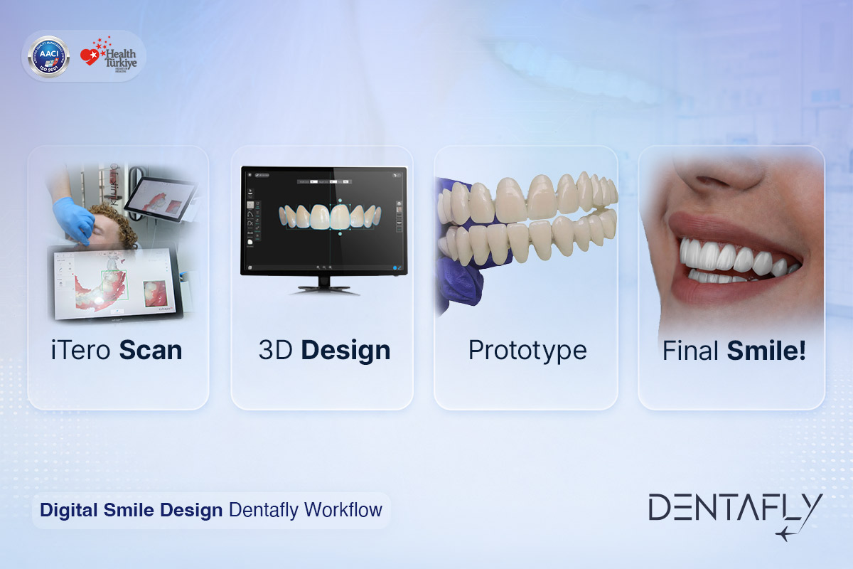 Digital smile design DSD workflow Dentafly intraoral scan CAD CAM software preview before treatment Antalya cosmetic dentistry