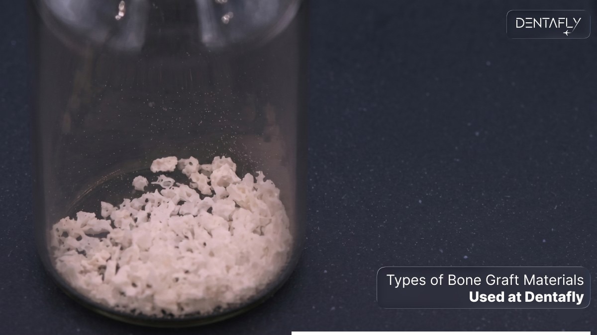 Premium Geistlich Bio-Oss xenograft material used at Dentafly for dental bone grafting procedures