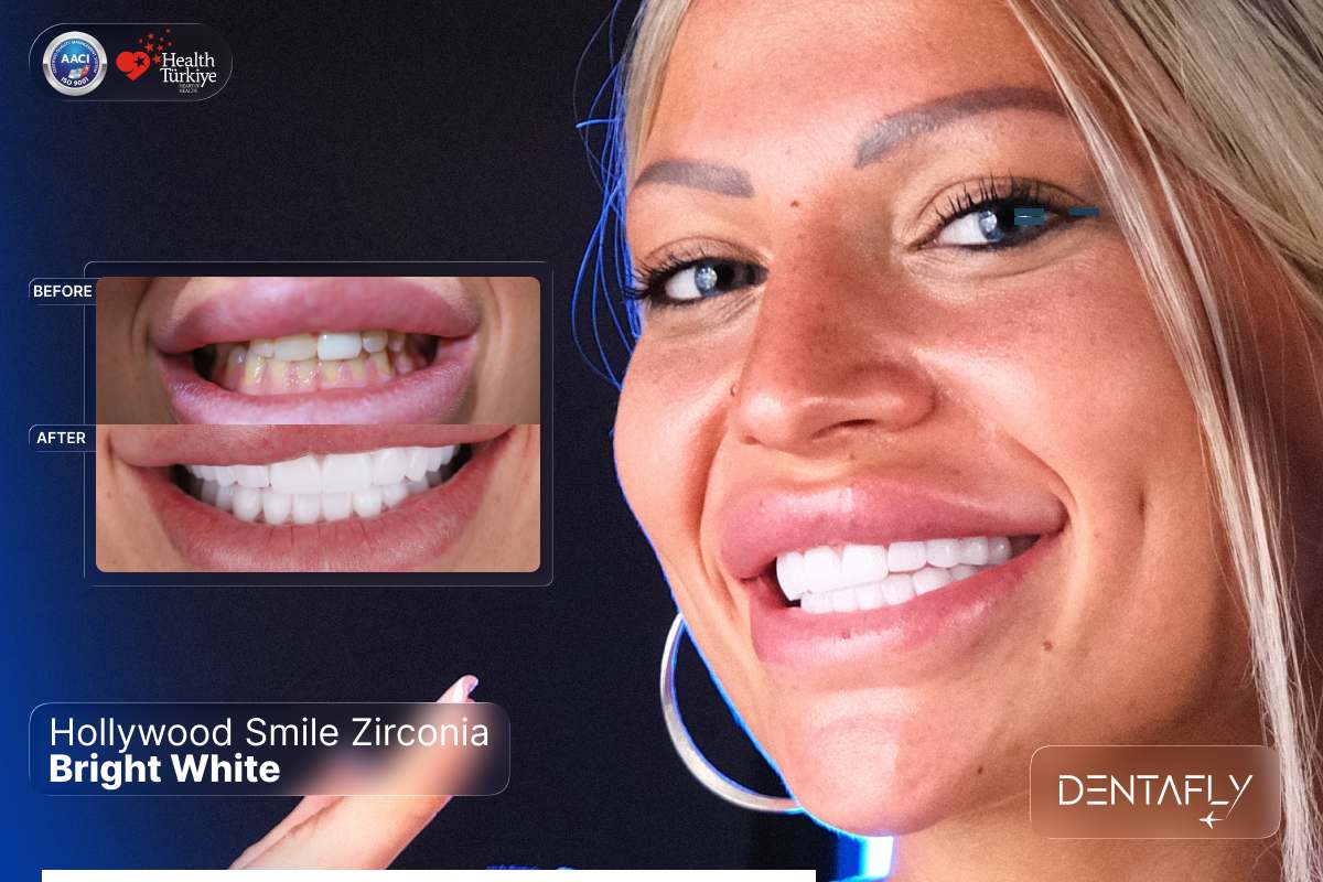 Hollywood smile zirconia bright white BL1 BL2 BL3 veneers crowns before after UK patient cosmetic dentistry dramatic transformation Dentafly Antalya