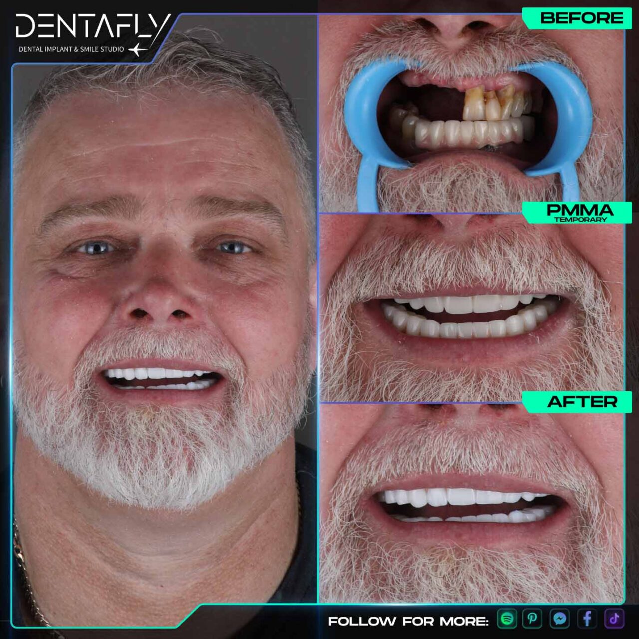 John Robertson smile before and after