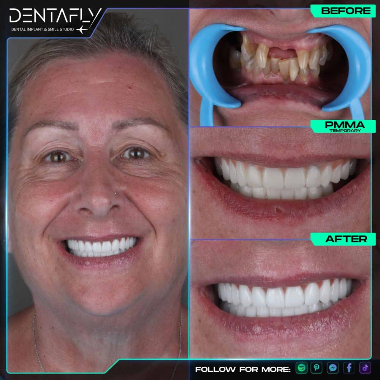 Karen Vallance smile before and after