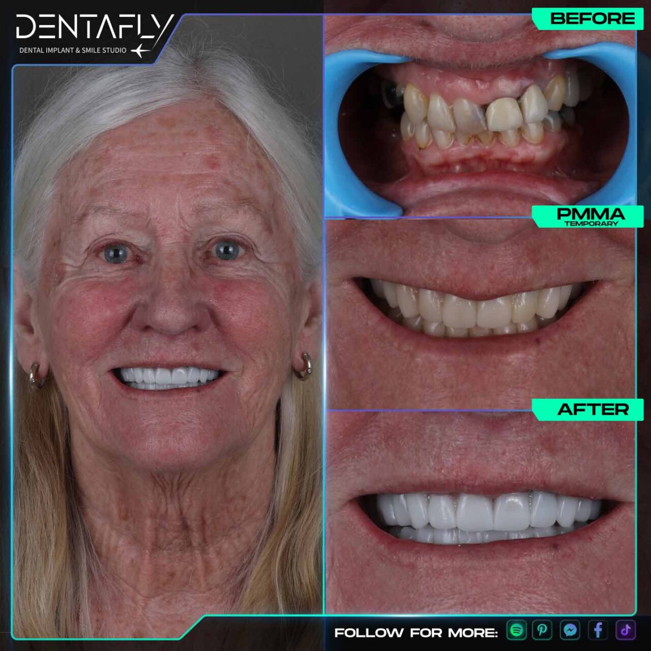Kathleen Sellar smile before and after