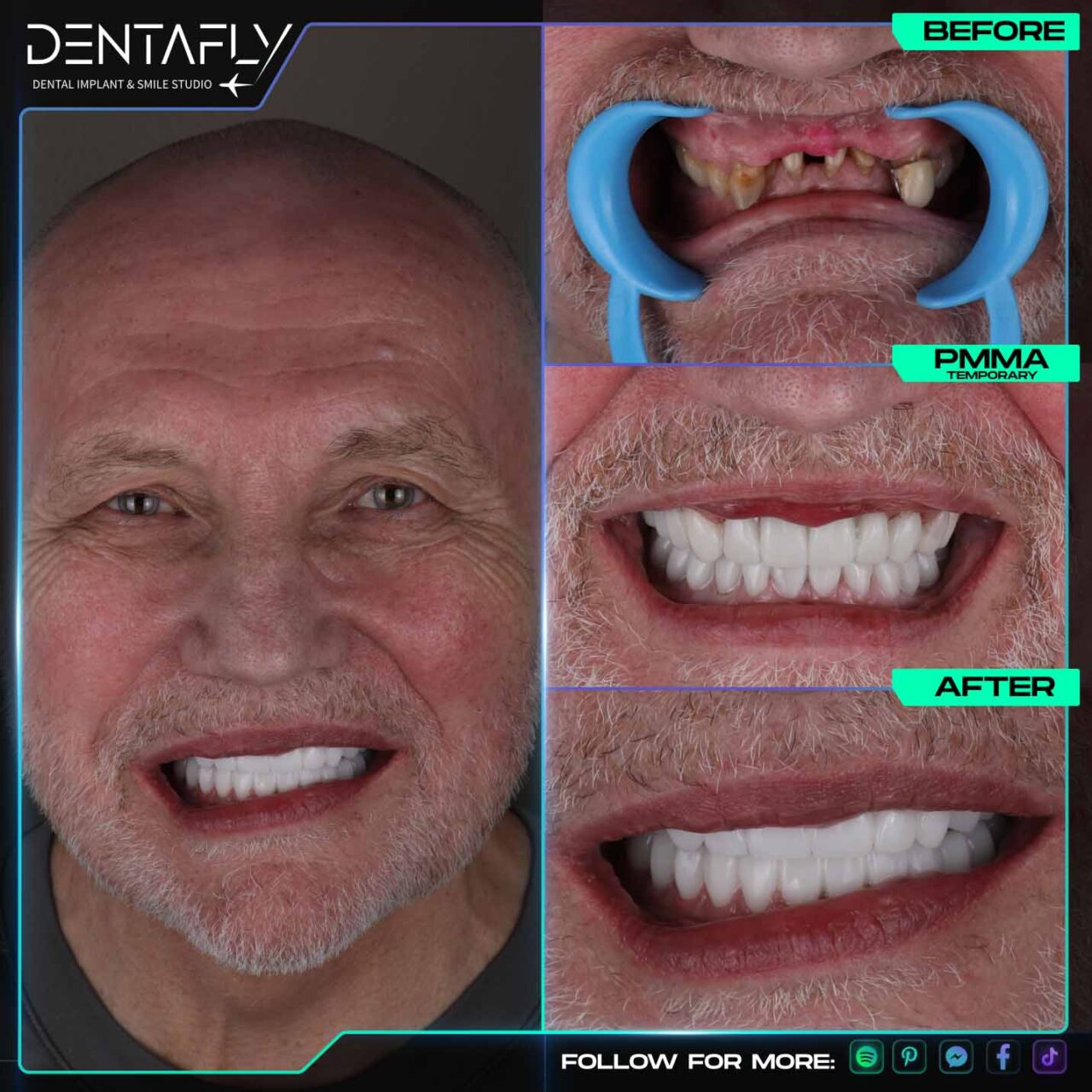 Michael Mcguire smile before and after