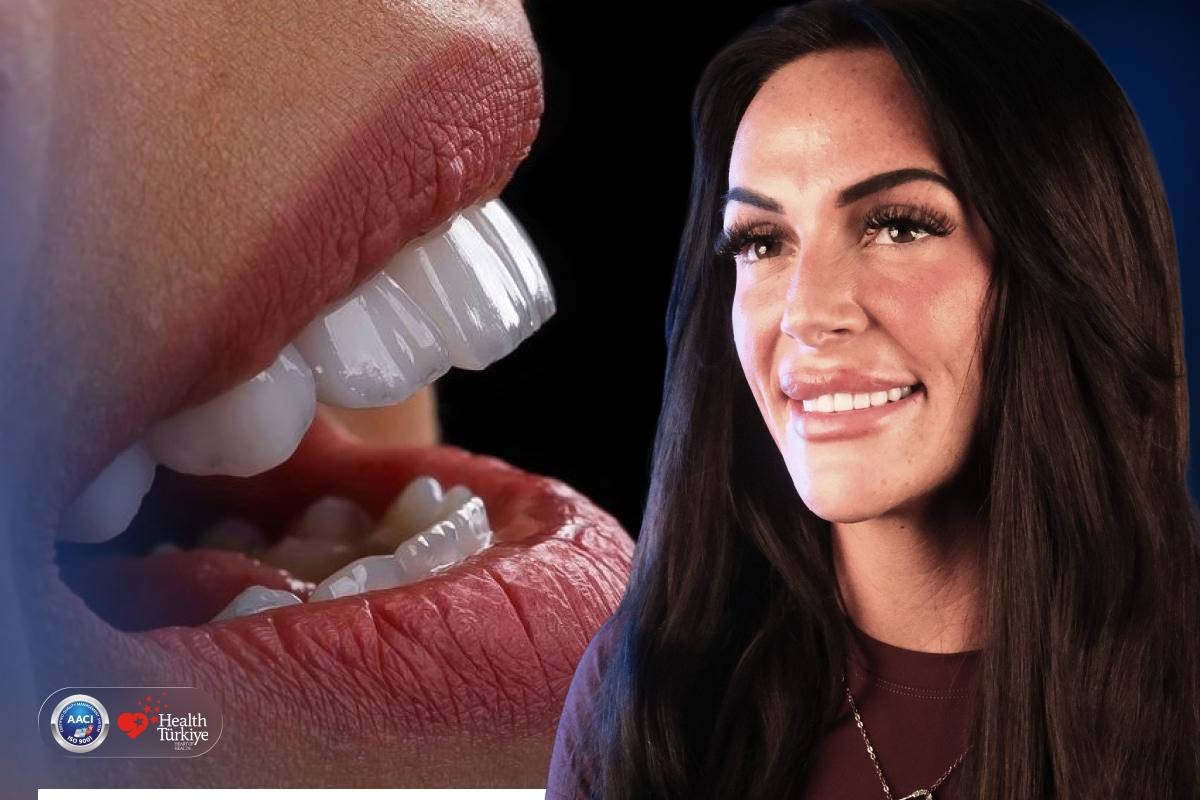 Natural smile makeover E.max translucent realistic VITA A1 A2 B1 veneers UK patient cosmetic dentistry subtle refinement Dentafly Antalya