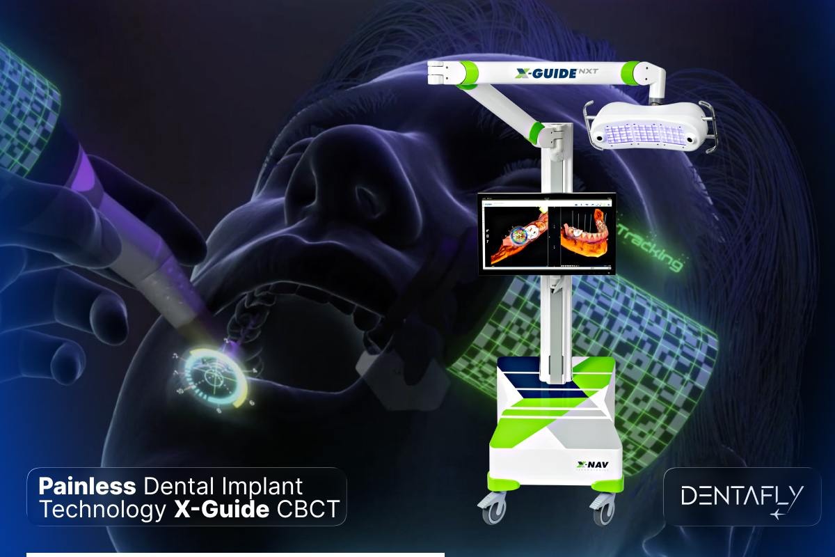 Painless dental implant technology CBCT 3D scanner X-Guide robotic system iTero digital impression precision