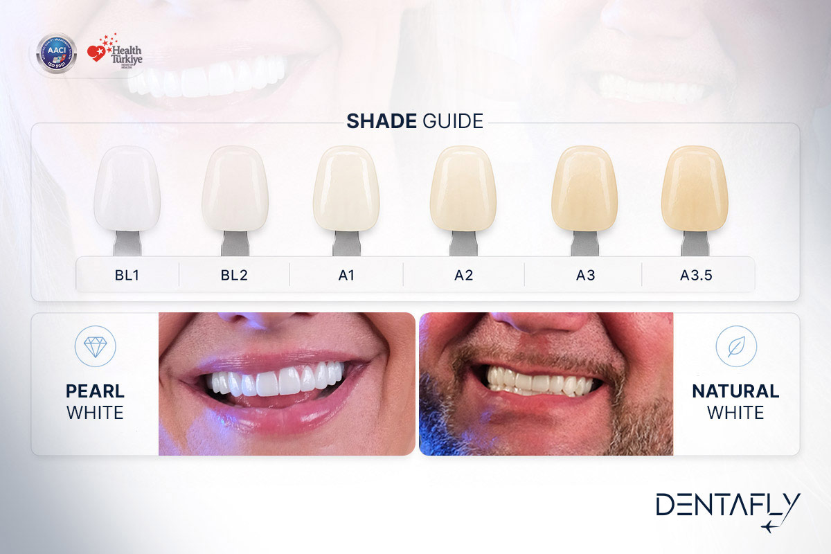 Pearl white versus natural color shade guide smile makeover comparison VITA scale Hollywood look natural appearance UK patients