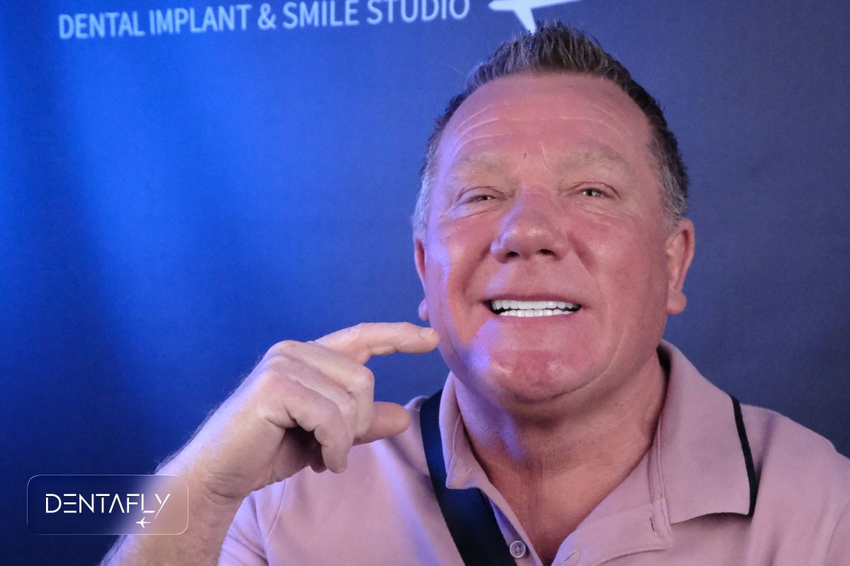 Real UK patient before and after single tooth implant treatment showing successful restoration