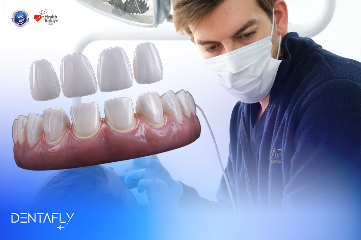 How many teeth smile makeover options 4 6 8 10 16 20 28 unit veneer crown combination decision guide Dentafly