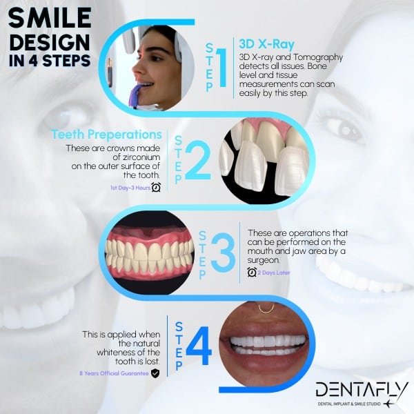 Smile design in 4 steps
