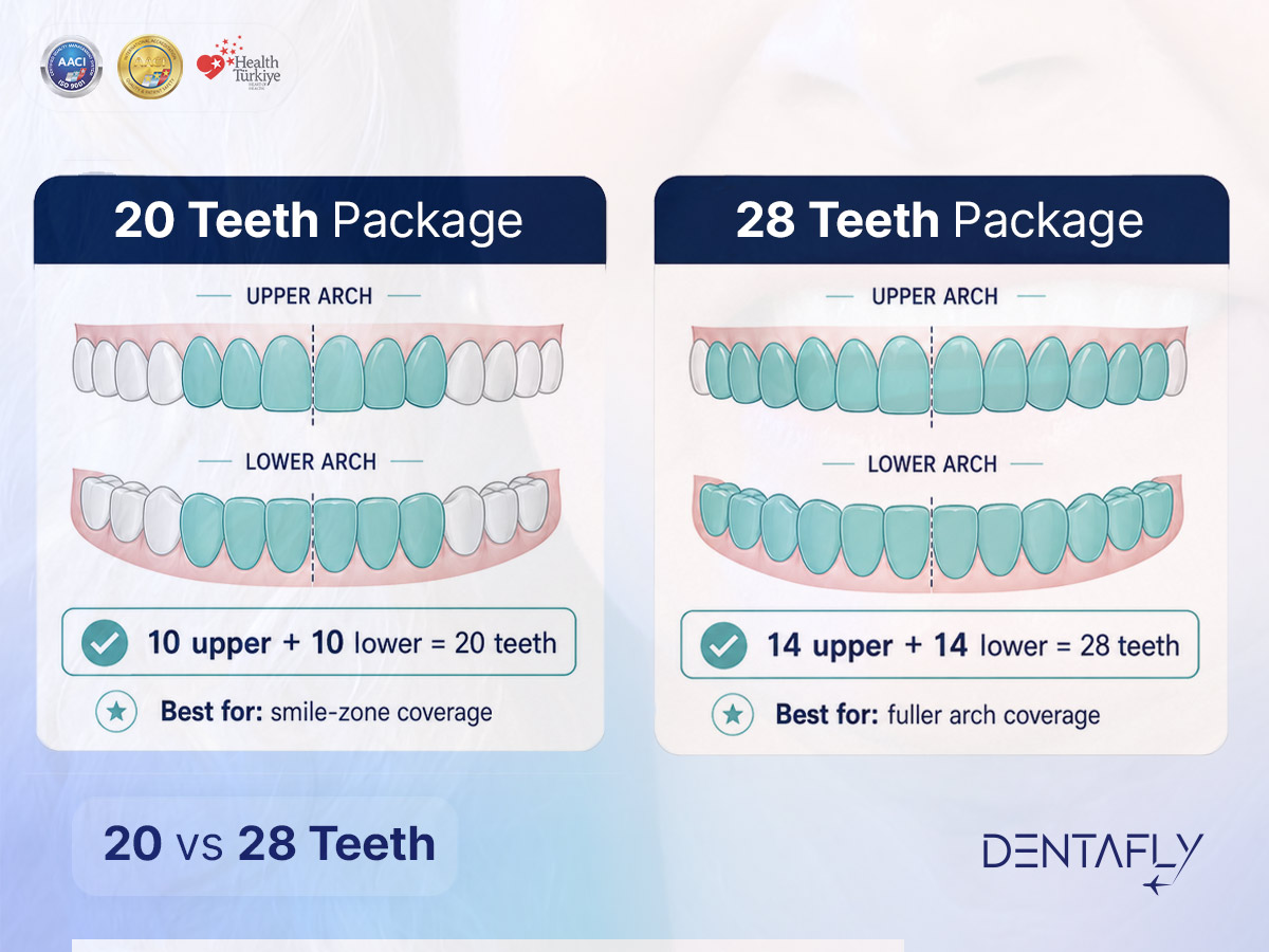 How many teeth a full set of veneers covers 20 vs 28 teeth full set veneers package coverage comparison