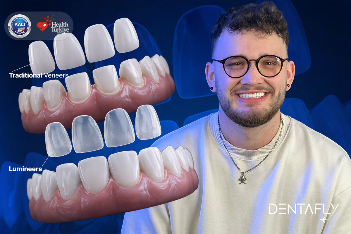 Patient showcasing a perfect smile after getting Lumineers in Turkey
