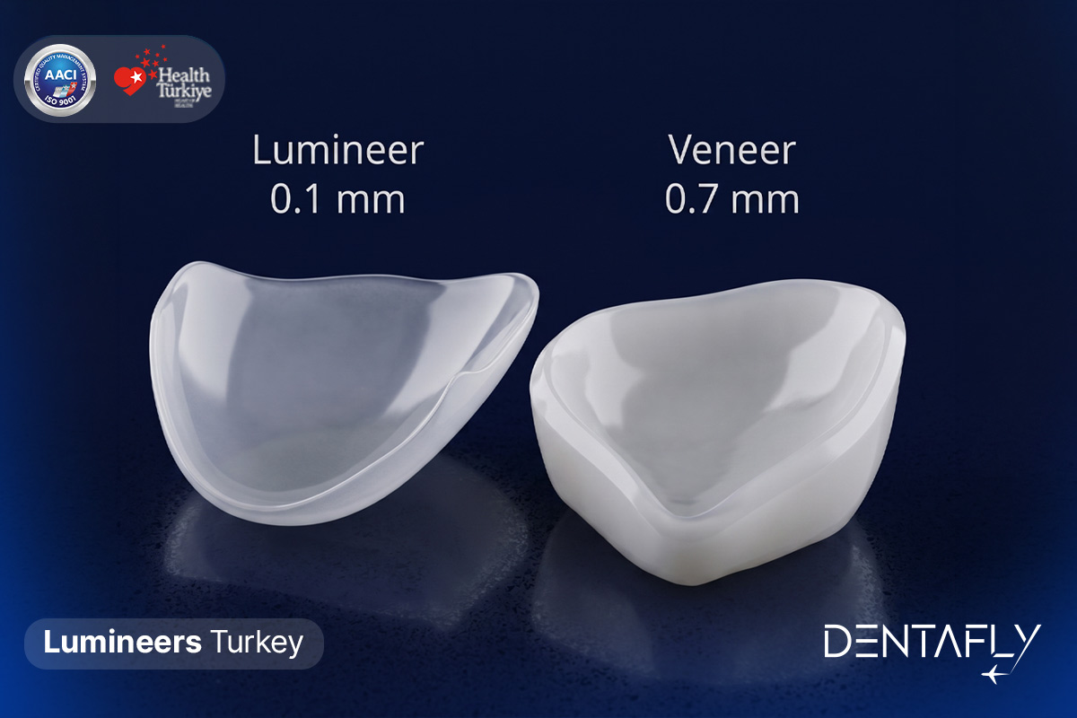 Modern, state-of-the-art dental clinic in Turkey offering Lumineers