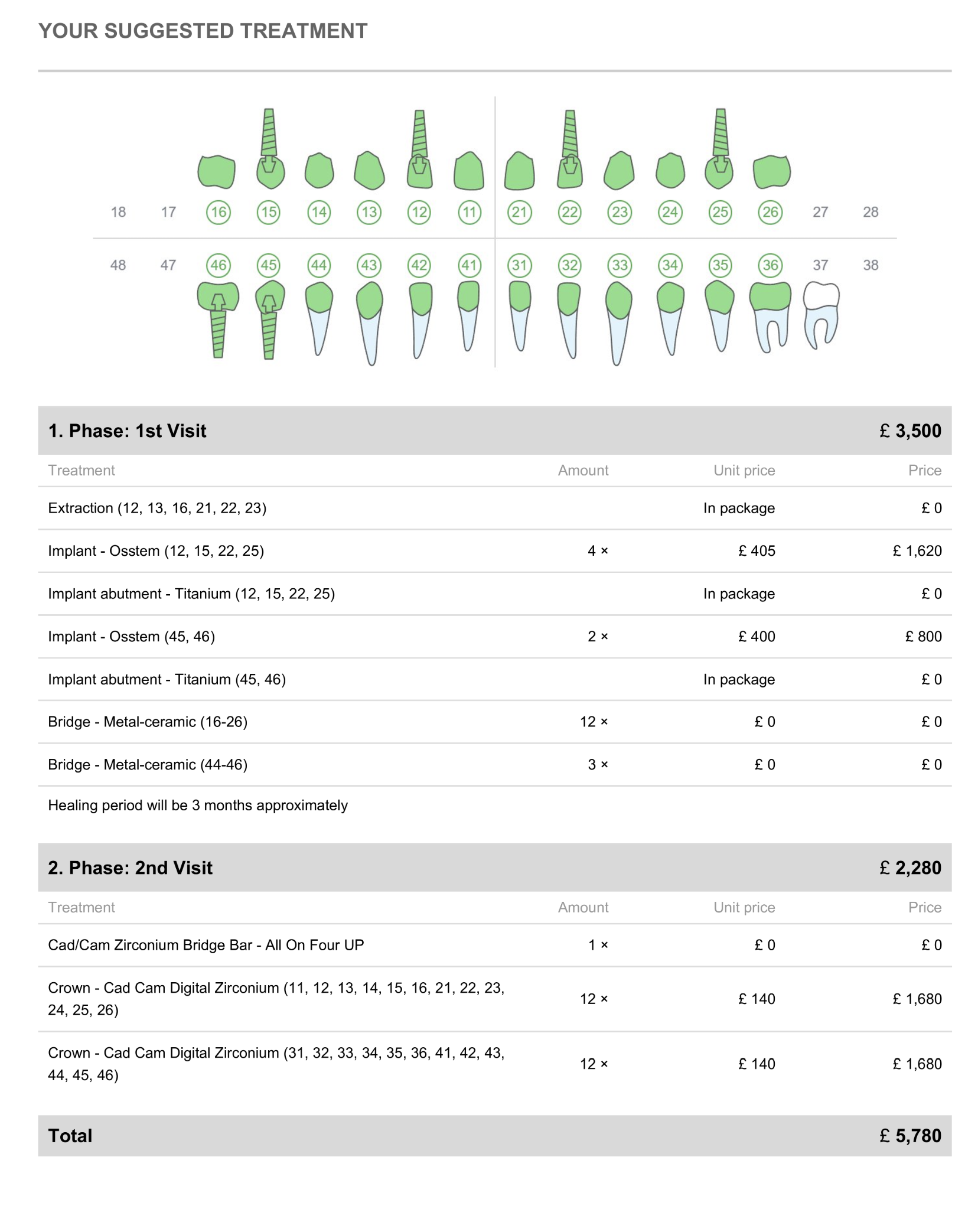 Real DentaFly quote: 4 implants and 24 zirconium crowns itemised over two visits, total £4,768